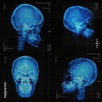 Скачать песню Drip Harder - Рентген